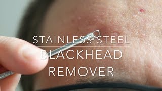 Stainless Steel Blackhead Acne Remover