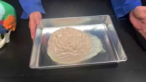 The Science of a Concussion!