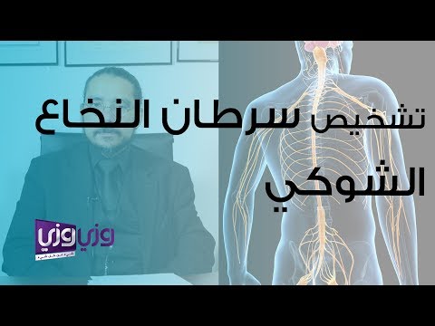 فيديو: هل يمكن أن ينتشر سرطان النخاع؟