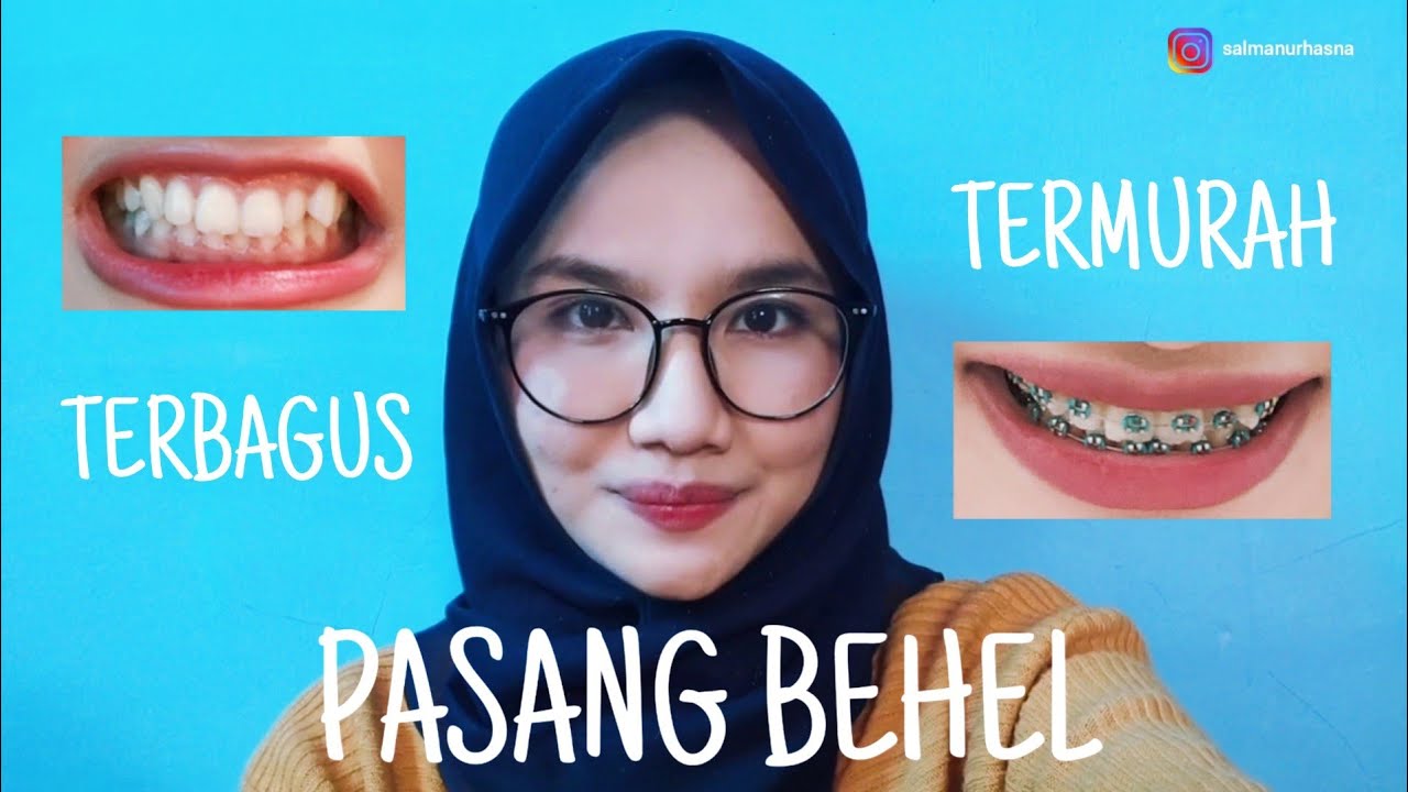 Pengalaman Biaya Lengkap Pasang Behel Atas Bawah Bagus Murah Di Kota Bandung Saat Pandemi Corona 