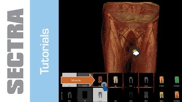 Tutorial Sectra IDS7 Touch - Presets and Global Illumination