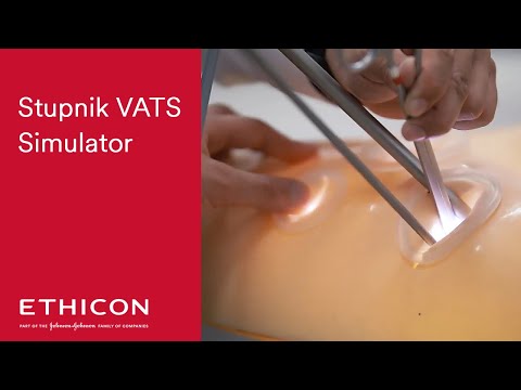 Stupnik Simulator: portable system to enhance core VATS skills | ETHICON