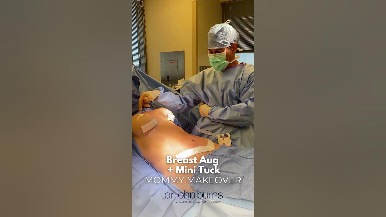 Dallas Mommy Makeover- Tummy Tuck + Lipo 360- Dr. John Burns – Dr John Burns