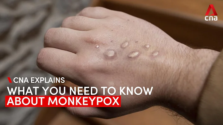 CNA Explains: What you need to know about monkeypox and if you should be concerned - DayDayNews