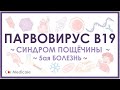 Парвовирус - симптомы, диагностика, лечение