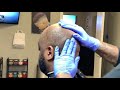 Hydro Therapy Bald Shave/Beard Wash/Sculpt