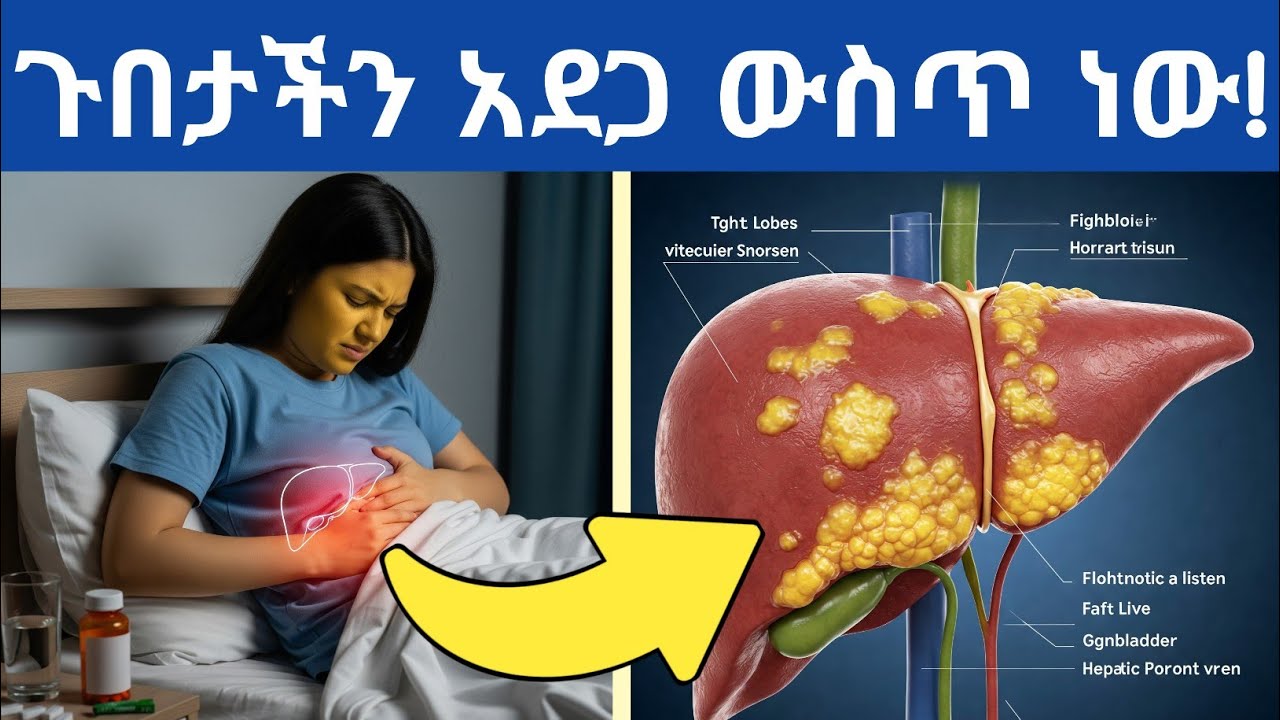 ጉበታችን እየተቸገረ መሆኑን የሚያሳዩ ማስጠንቀቂያ 10 ምልክቶች እና የጉበትን ጤና የሚደግፉ አመጋገቦች| 10 Signs Your Liver Is Struggling