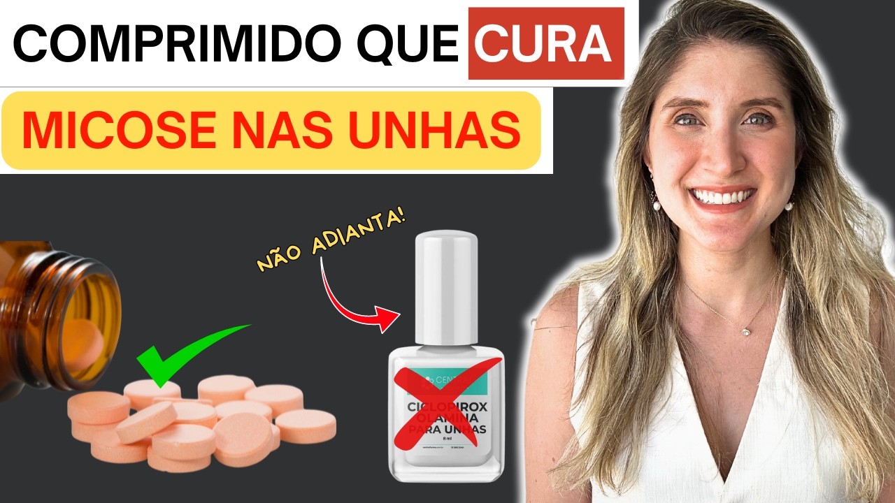 Remédio que CURA MICOSE na Unha- Terbinafina (Zior/Funtyl)- [Preferido dos Dermatos]