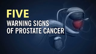 Is It Prostate Cancer? Don't Ignore These 5 Warning Signs of Prostate Cancer!