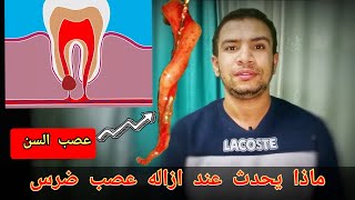 ماذا يحدث للجهاز العصبي بعد ازاله العصب من ضرس |حقيقه حشو العصب