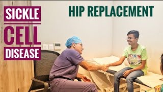 17 Year Old Boy with Sickle Cell Disease AVN gets Hip Replacement