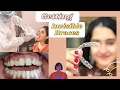 Getting Invisible braces in India | My Toothsi Aligners Review | Invisible Aligners- Process & Cost
