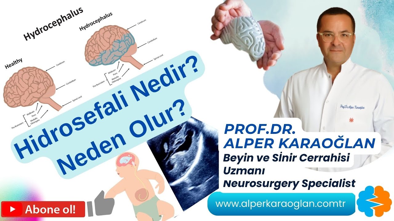 Что такое гидроцефалия? Почему это происходит? | Проф. Др. Альпер КАРАОГЛАН