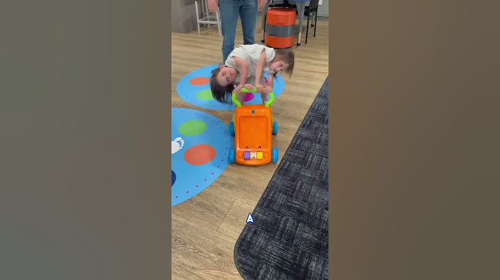 Conjoined twins defy the odds! ❤️