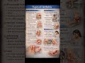 Main Types of Arthritis | Causes, Symptoms &amp; Warning Signs | Arthritis Explained #shorts #arthritis