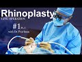 Dr steven pearlman  rhinoplasty surgery 1  part 1