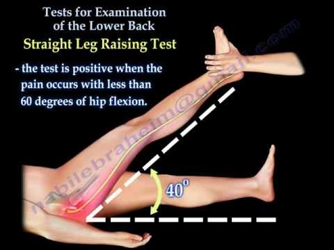 Sindrom piriformis terjadi ketika otot piriformis menekan saraf sciatic, yaitu saraf besar yg memben. 