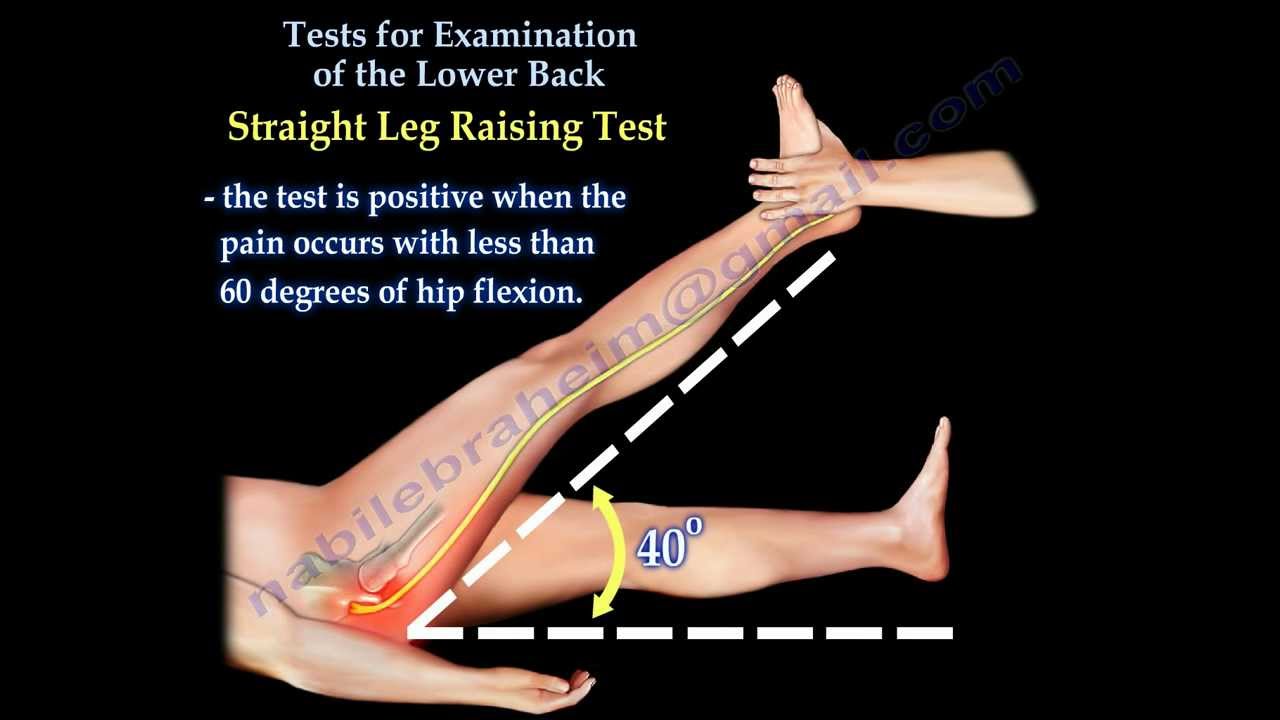 Tests For Examination Of The Lower Back - Everything You Need To Know - Dr.  Nabil Ebraheim 