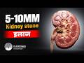 5-10mm Kidney Stone Treatment Without Surgery? | 5-10mm किडनी स्टोन इलाज #kkidneystonetreatment
