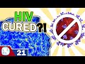 Second Person Cured of HIV! HIV News 2020