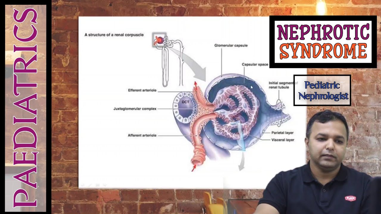 Pediatrics Nephrotic Syndrome Made Easy By Dr. Shankar Yadav
