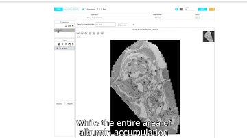 No-code AI tool for 20 Gigabytes Image | DeepBlock.net | Computer Vision Toolbox for Microscopy