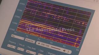 The AI voice app that detects COPD flare-ups earlier screenshot 5