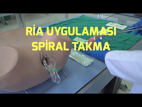 Video: Spiral ampullere ne ad verilir?