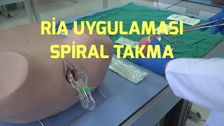 Spiral (RİA) Uygulaması Nasıl Yapılır?