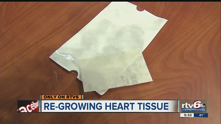 Extra-cellular matrix patch helps heart patients regrow their own healthy tissue