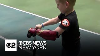 Long Island boy believed to be the youngest recipient of a bionic arm
