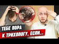 Волосы стали слишком жирные! / 5 основных причин, когда нужно срочно идти к трихологу