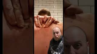 Infected cyst explosion !!!!