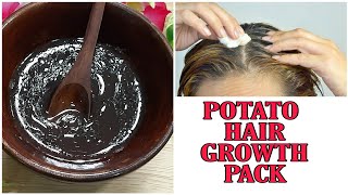 Potato Hair Growth Pack || Cinderella Beauty Tips