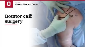 Rotator cuff surgery | Ohio State Medical Center