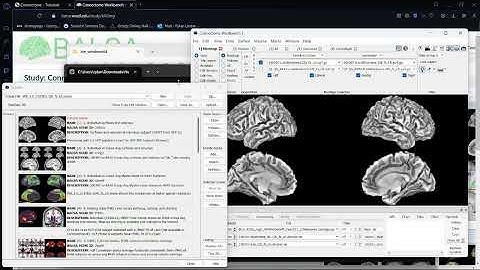 Human Connectome: Downloading and Using Data
