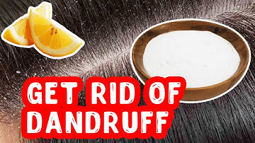 How To Get Rid Of Dandruff With Baking Soda