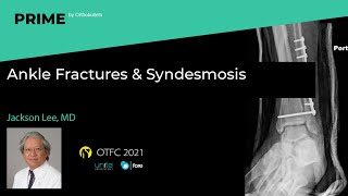 Ankle Fractures & Syndesmosis  Jackson Lee, MD