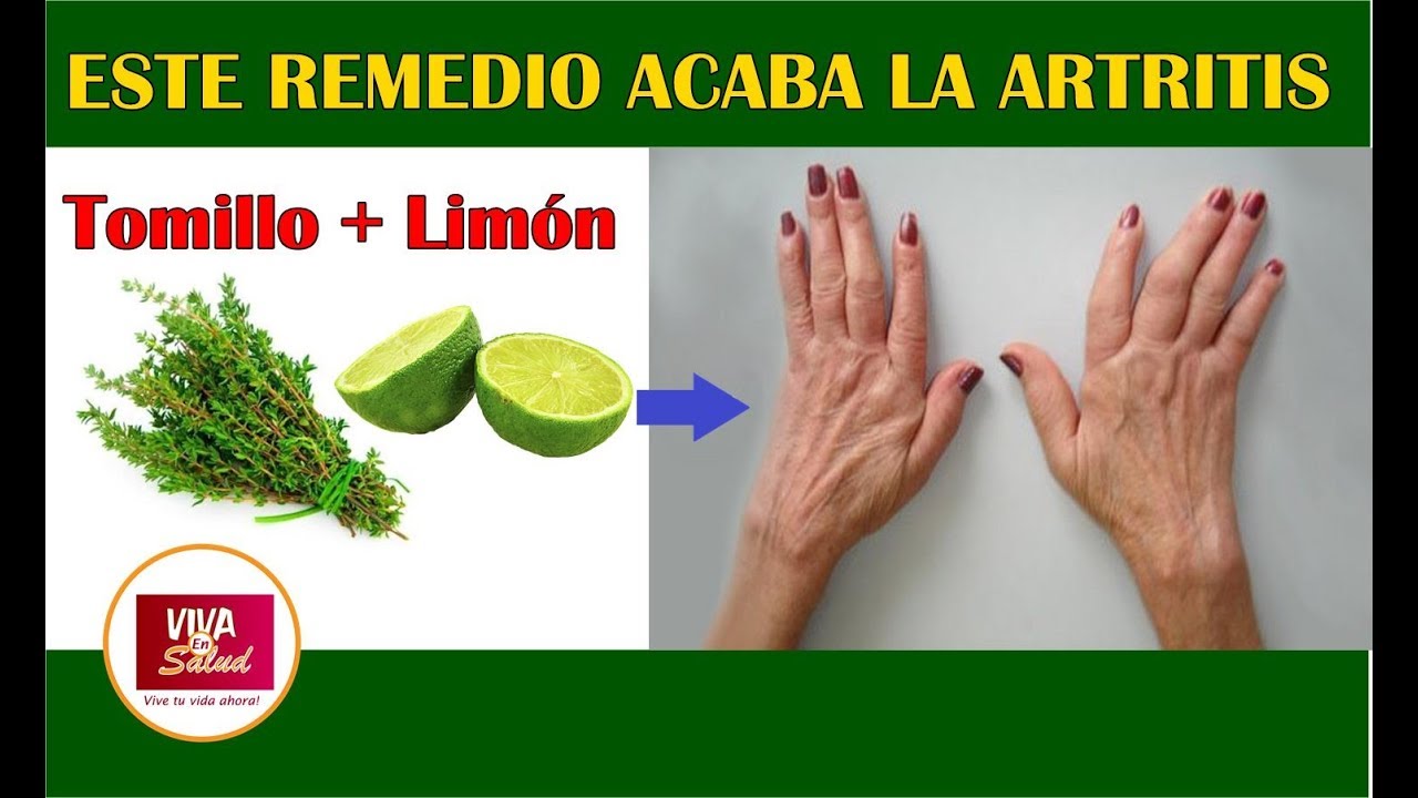 Remedios para la artritis en los dedos de la mano