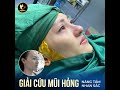 tham my vien sai gon 2022 New Giải cứu mũi hỏng | Bs.Hoạt | TMV Saigon Star