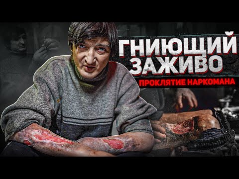 ГНИЮЩИЙ ЗАЖИВО | ПРОКЛЯТЬЕ НАРКОМАНА