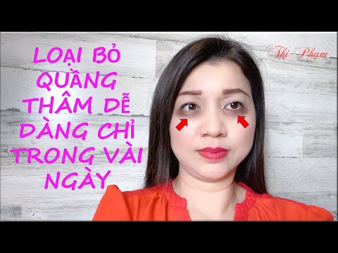 Nguyên Nhân Và Cách Trị  Quầng Thâm Mắt // How To Get Rid Of Dark Circles and Bags Under Eyes Fast!