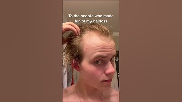 Thumbnail of To the people who made fun of my hairloss