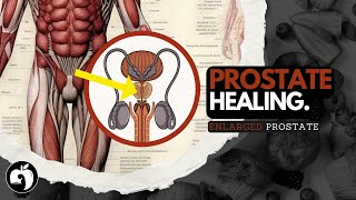 Top 5 Foods To SHRINK An Enlarged PROSTATE [GUARANTEED]