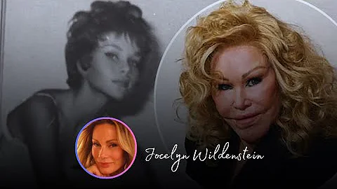 The Transformation Of Jocelyn Wildenstein Is Seriously So Sad