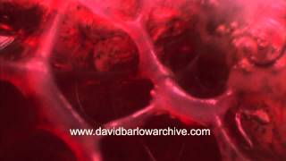 Interior of the Frog Lung by David Barlow 2,592 views 9 years ago 1 minute, 5 seconds