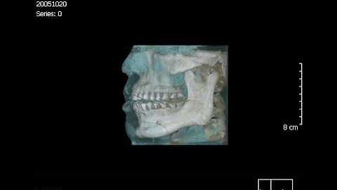 Movie Clip from OnDemand3D