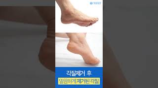 심플_각질제거양말 (3)
