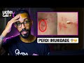 Herpes Zoster: Por que um trabalho novo me deixou doente? | LIÇÕEScast Solo