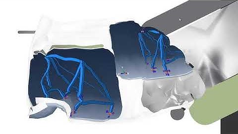 Proyecto Final Metodo del Elemento Finito